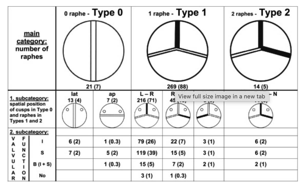Classificação de Sievers - Tipos 0, 1 e 2
